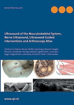 portada Ultrasound of the Musculoskeletal System, Nerve Ultrasound, Ultrasound Guided Interventions and Arthroscopy Atlas (en Inglés)