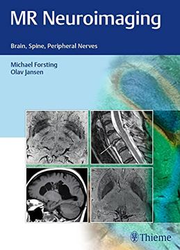 portada MR Neuroimaging: Brain, Spine, Peripheral Nerves (en Inglés)
