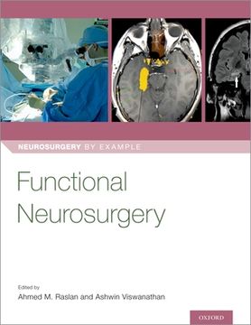 portada Functional Neurosurgery (Neurosurgery by Example) (en Inglés)