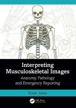 portada Interpreting Musculoskeletal Images: Anatomy, Pathology and Emergency Reporting 