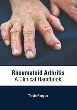 portada Rheumatoid Arthritis: A Clinical Handbook 
