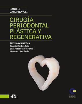portada Cirugia Periodontal Plastica y Regenerativa