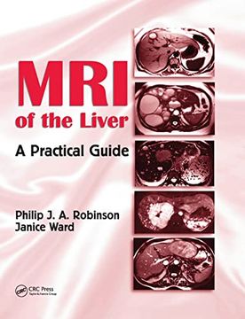 portada Mri of the Liver: A Practical Guide (en Inglés)