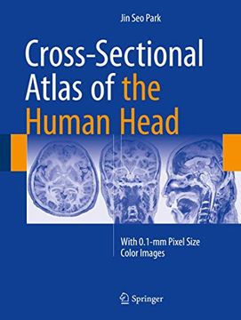 portada Cross-Sectional Atlas of the Human Head: With 0.1-MM Pixel Size Color Images (en Inglés)