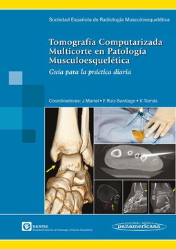 portada Tomografía Computarizada Multicorte en Patología Musculoesquelética: Guía Para la Práctica Diaria 