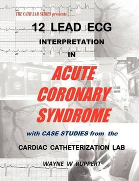 12 lead ecg interpretation in acute coronary syndrome with case studies from the cardiac catheterization lab