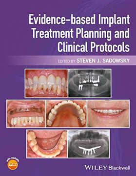portada Evidence-Based Implant Treatment Planning and Clinical Protocols