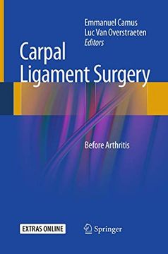 portada Carpal Ligament Surgery: Before Arthritis (en Inglés)