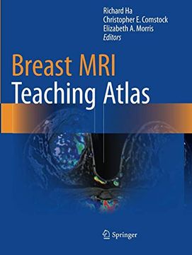 portada Breast mri Teaching Atlas (en Inglés)