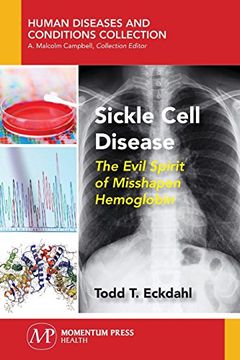 portada Sickle Cell Disease: The Evil Spirit of Misshapen Hemoglobin