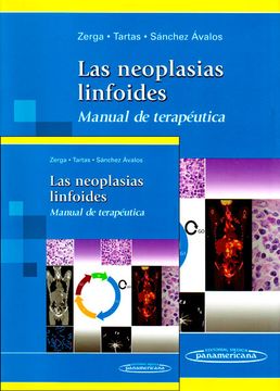 portada LAS NEOPLASIAS LINFOIDES. MANUAL DE TERAPEUTICA (in Spanish)