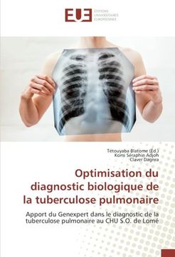 portada Optimisation du diagnostic biologique de la tuberculose pulmonaire (OMN.UNIV.EUROP.)