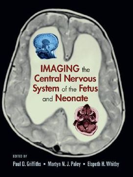 portada imaging the central nervous system of the fetus and neonate