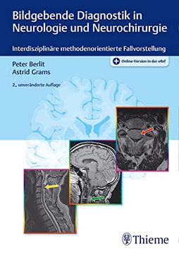 portada Bildgebende Diagnostik in Neurologie und Neurochirurgie: Interdisziplinäre Methodenorientierte Fallvorstellung (in German)