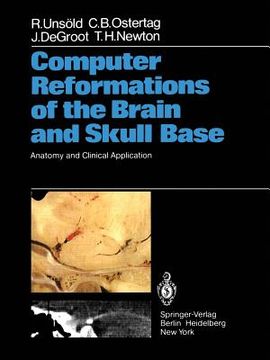 portada computer reformations of the brain and skull base: anatomy and clinical application (en Inglés)