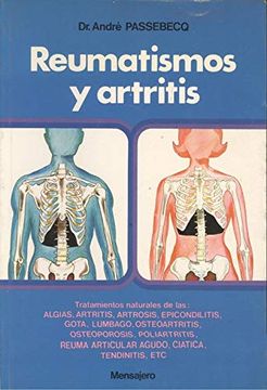 portada Reumatismos y Artritis (in Spanish)
