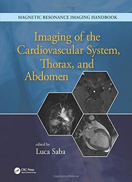 portada Imaging of the Cardiovascular System, Thorax, and Abdomen: Volume 2 (Magnetic Resonance Imaging Handbook)