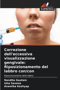 portada Correzione dell'eccessiva visualizzazione gengivale: Riposizionamento del labbro con/con (en Italiano)
