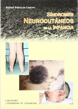 portada Síndromes Neurocutáneos en la Infancia