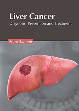 portada Liver Cancer: Diagnosis, Prevention and Treatment (in English)