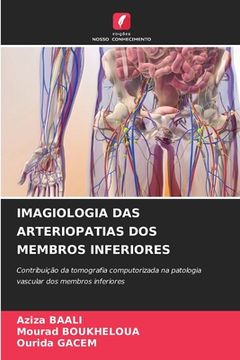 portada Imagiologia Das Arteriopatias DOS Membros Inferiores (in Portuguese)
