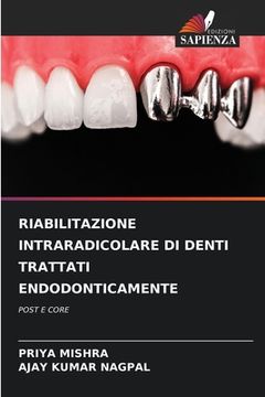 portada Riabilitazione Intraradicolare Di Denti Trattati Endodonticamente (en Italiano)