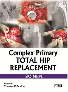 portada complex primary total hip replacement (en Inglés)