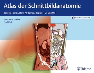 portada Atlas der Schnittbildanatomie: Band ii: Thorax, Herz, Abdomen, Becken (en Alemán)