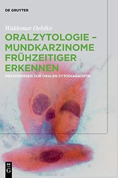 portada Oralzytologie: Mundkarzinome frã Â¼Hzeitiger Erkennen; Praxiswissen zur Oralen Zytodiagnostik (German Edition) [Hardcover ] (en Alemán)