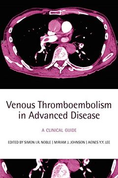 portada Venous Thromboembolism in Advanced Disease: A Clinical Guide (en Inglés)