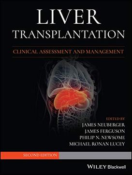 portada Liver Transplantation: Clinical Assessment and Management (in English)