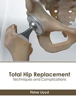 portada Total hip Replacement: Techniques and Complications (en Inglés)