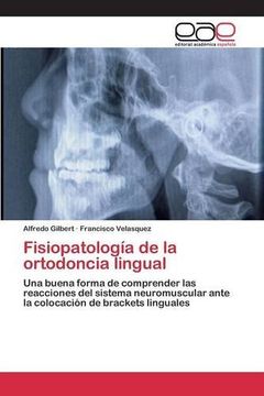 portada Fisiopatología de la ortodoncia lingual