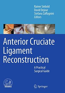 portada Anterior Cruciate Ligament Reconstruction: A Practical Surgical Guide (en Inglés)