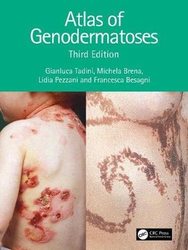portada Atlas of Genodermatoses (en Inglés)