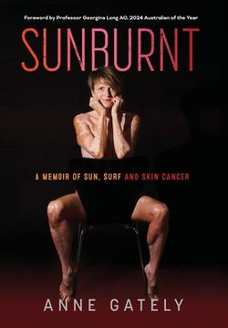 portada Sunburnt: A memoir of sun, surf and skin cancer (en Inglés)