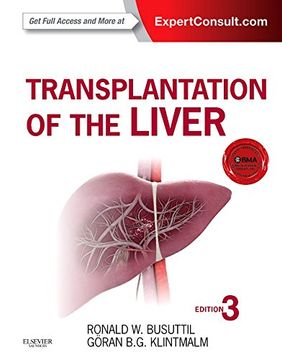 portada Transplantation of the Liver (en Inglés)