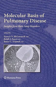 portada Molecular Basis of Pulmonary Disease: Insights From Rare Lung Disorders (Respiratory Medicine) (in English)