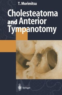 portada Cholesteatoma and Anterior Tympanotomy