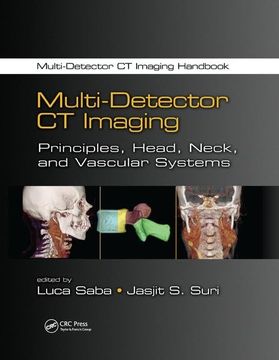 portada Multi-Detector CT Imaging: Principles, Head, Neck, and Vascular Systems (en Inglés)