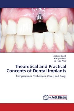 portada Theoretical and Practical Concepts of Dental Implants (en Inglés)