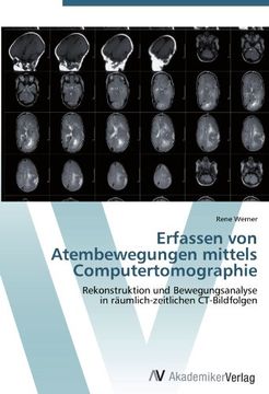 portada Erfassen von Atembewegungen mittels Computertomographie: Rekonstruktion und Bewegungsanalyse  in räumlich-zeitlichen CT-Bildfolgen