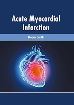 portada Acute Myocardial Infarction (en Inglés)