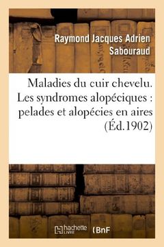 portada Maladies Du Cuir Chevelu. Les Syndromes Alopeciques: Pelades Et Alopecies En Aires (Sciences) (French Edition)