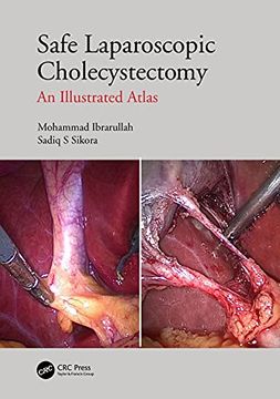 portada Safe Laparoscopic Cholecystectomy: An Illustrated Atlas (in English)