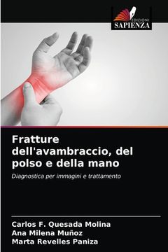 portada Fratture dell'avambraccio, del polso e della mano (en Italiano)