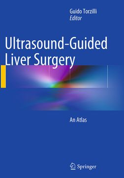 portada Ultrasound-Guided Liver Surgery: An Atlas (en Inglés)
