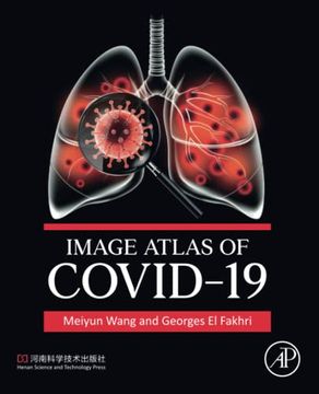 portada Image Atlas of Covid-19 (Paperback)