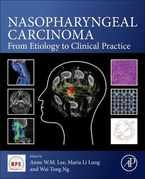 portada Nasopharyngeal Carcinoma: From Etiology to Clinical Practice (en Inglés)