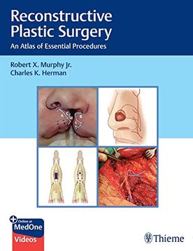 portada Reconstructive Plastic Surgery: An Atlas of Essential Procedures (en Inglés)